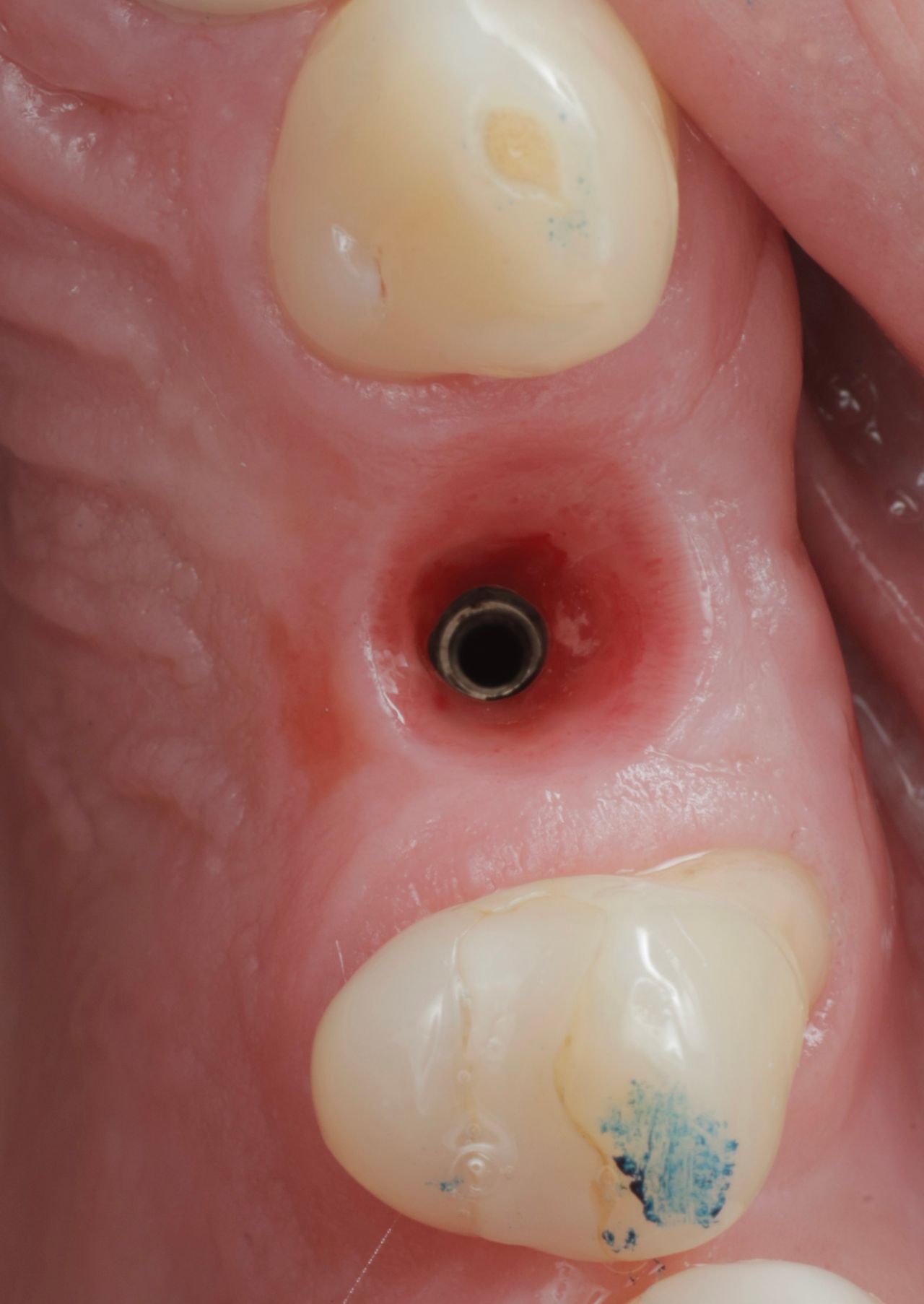 Marco Tulio Alzaga Vega-5