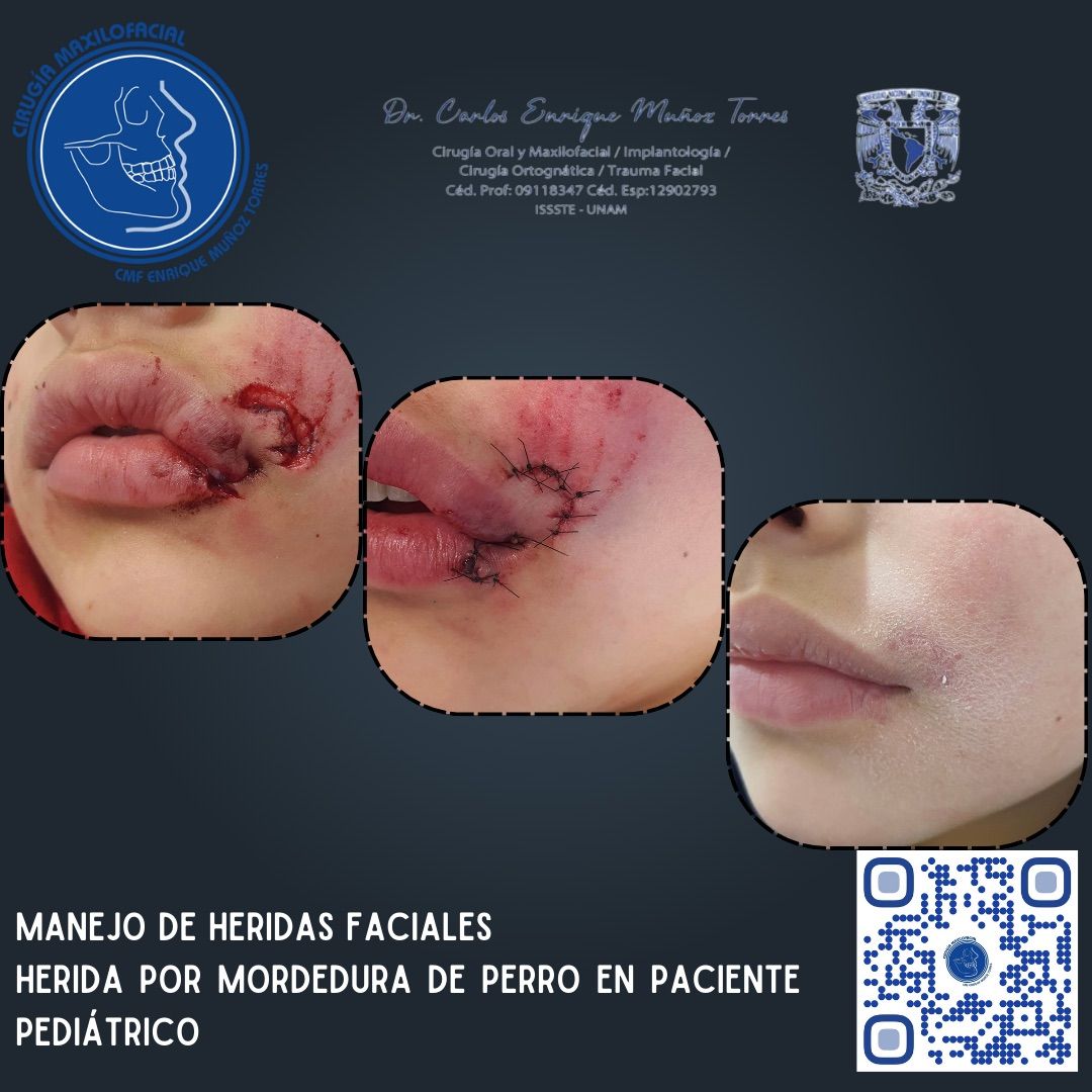 Carlos Enrique Muñoz Torres-9