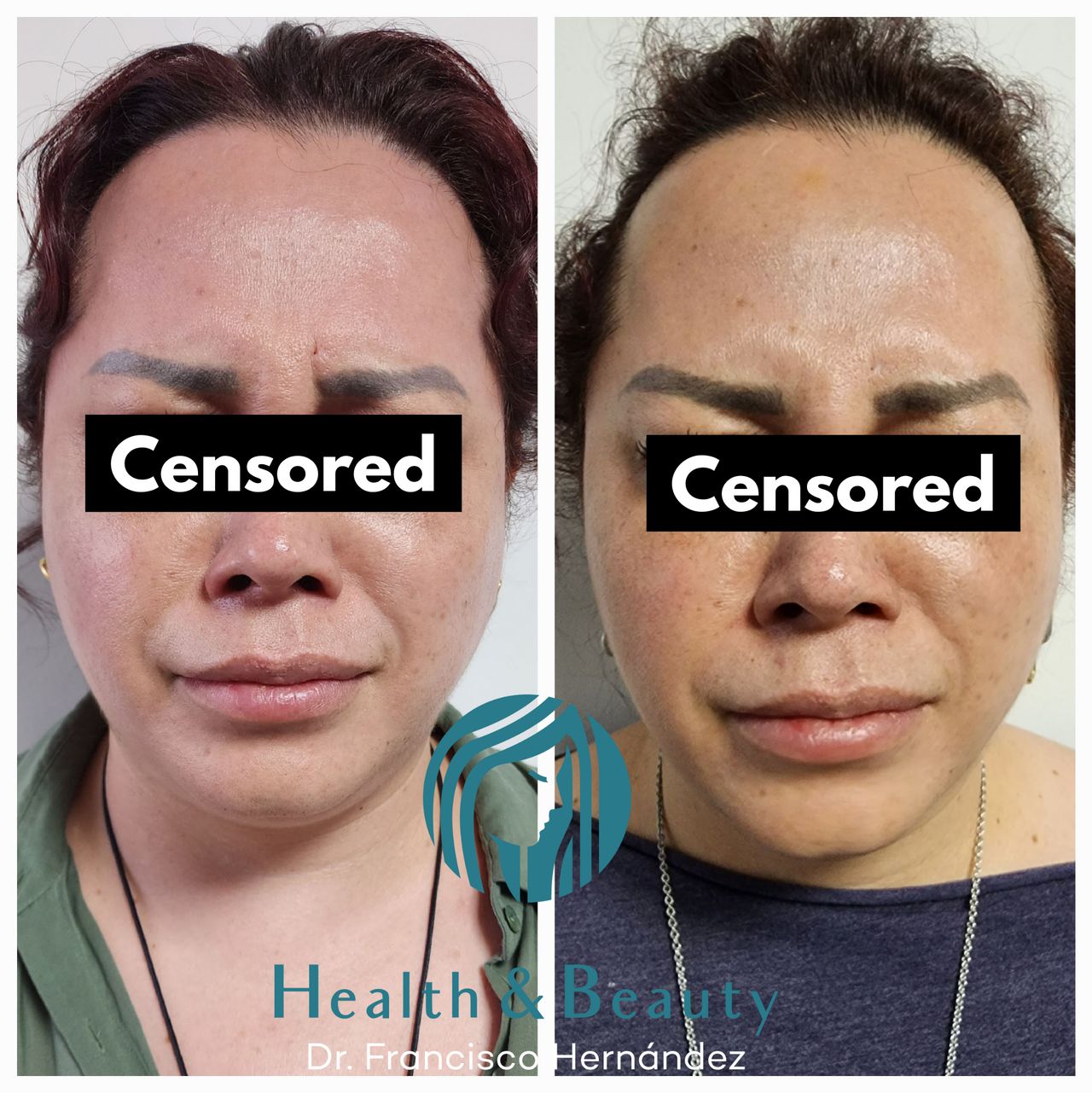 Francisco Hernández Gómez Crespo-62