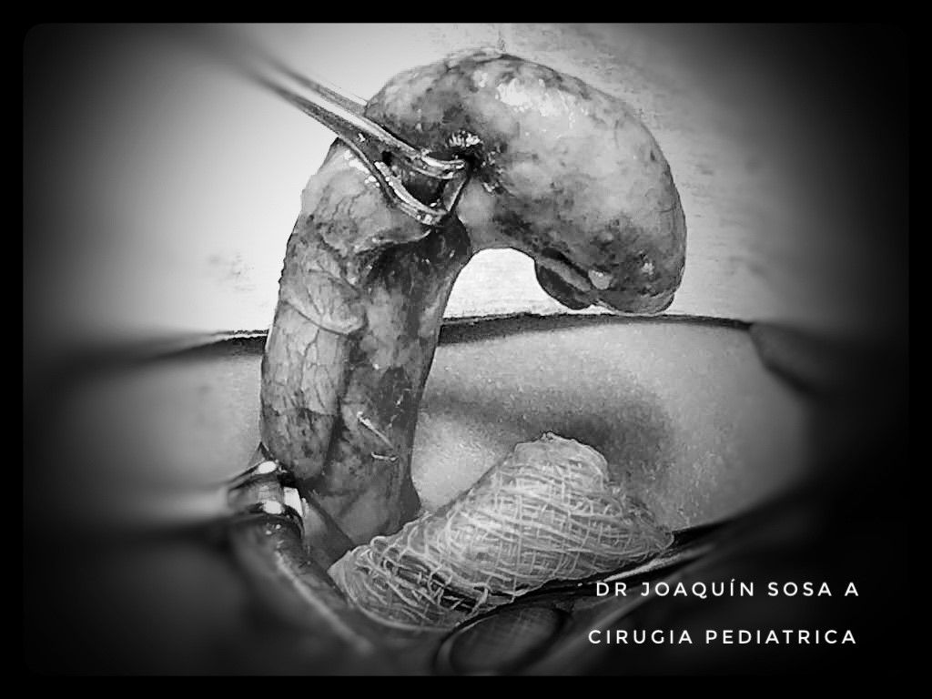 R. Joaquín Sosa Azcorra-27