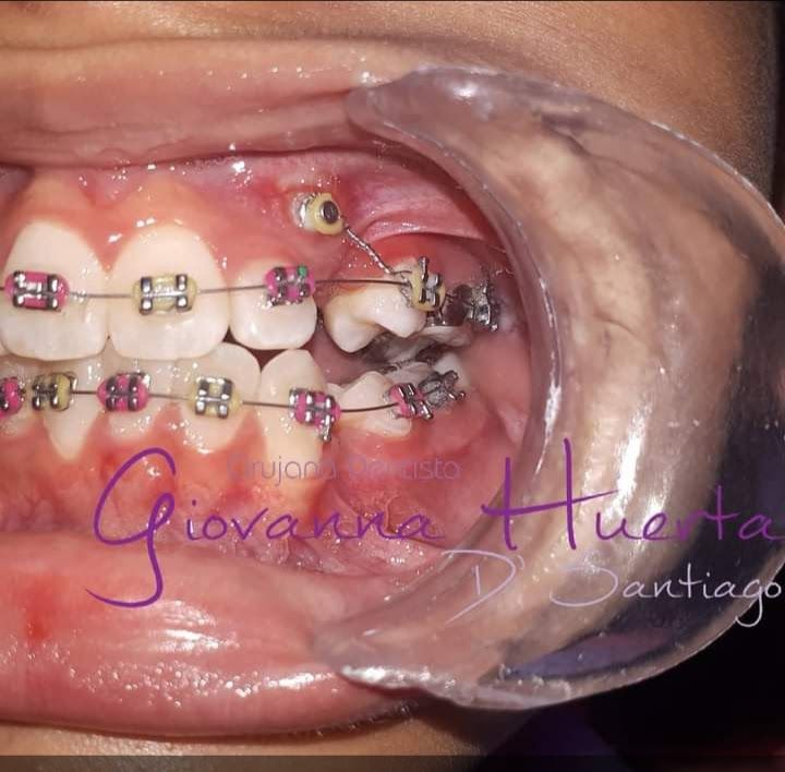 Giovanna Paola Huerta De Santiago-18