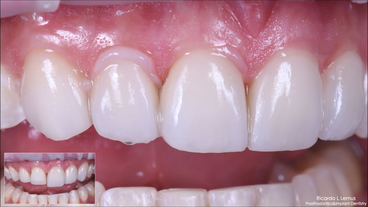 Ricardo López Lemus-114