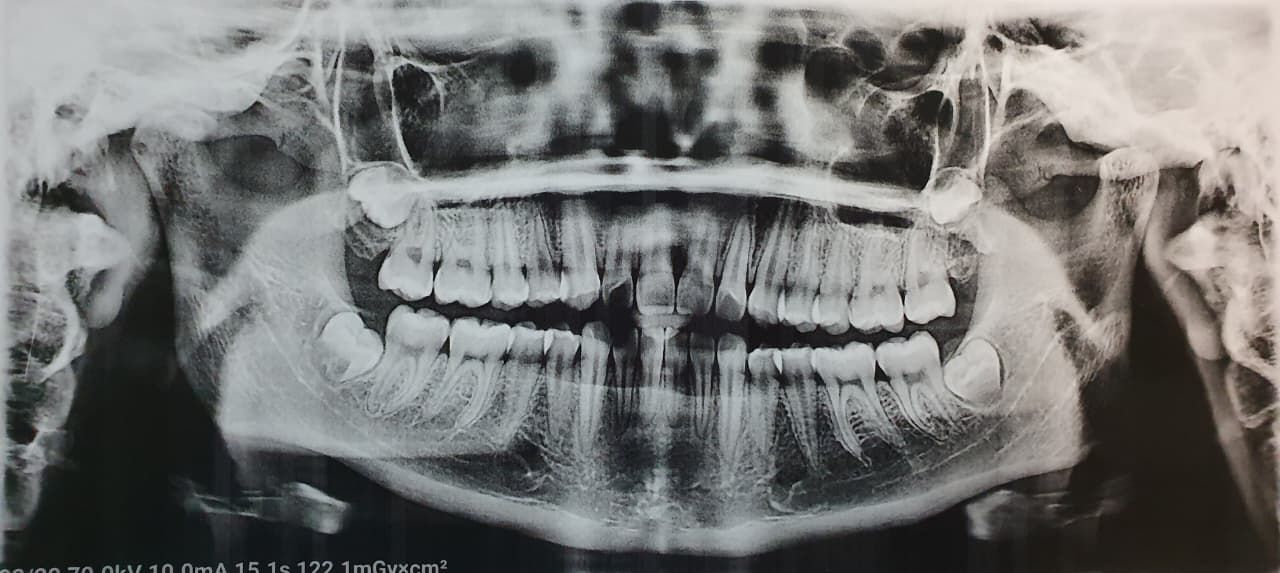 Fernando Olivier Victoriano-6