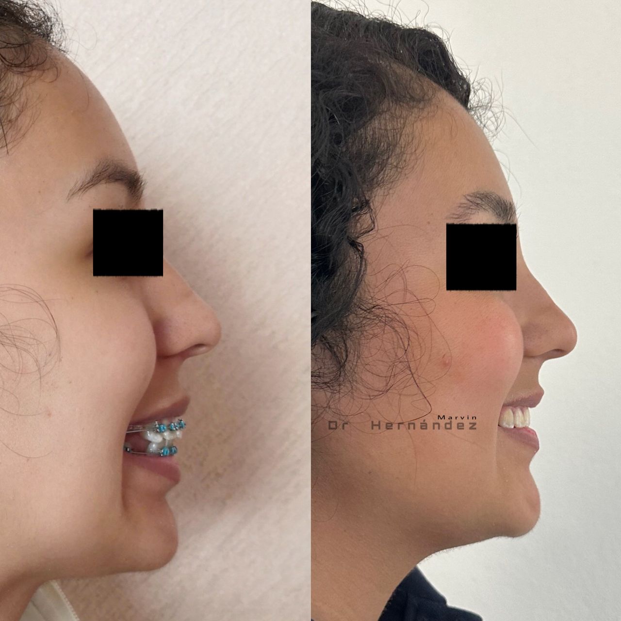 Marvin Adair Hernández Álvarez-14