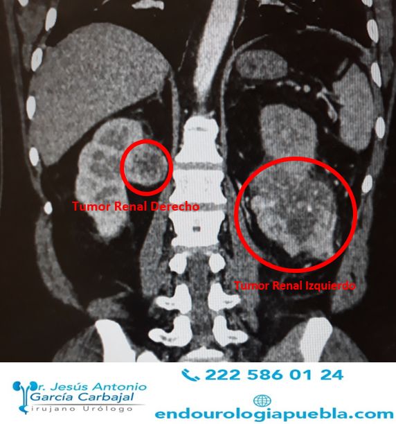 Jesús Antonio García Carbajal-10