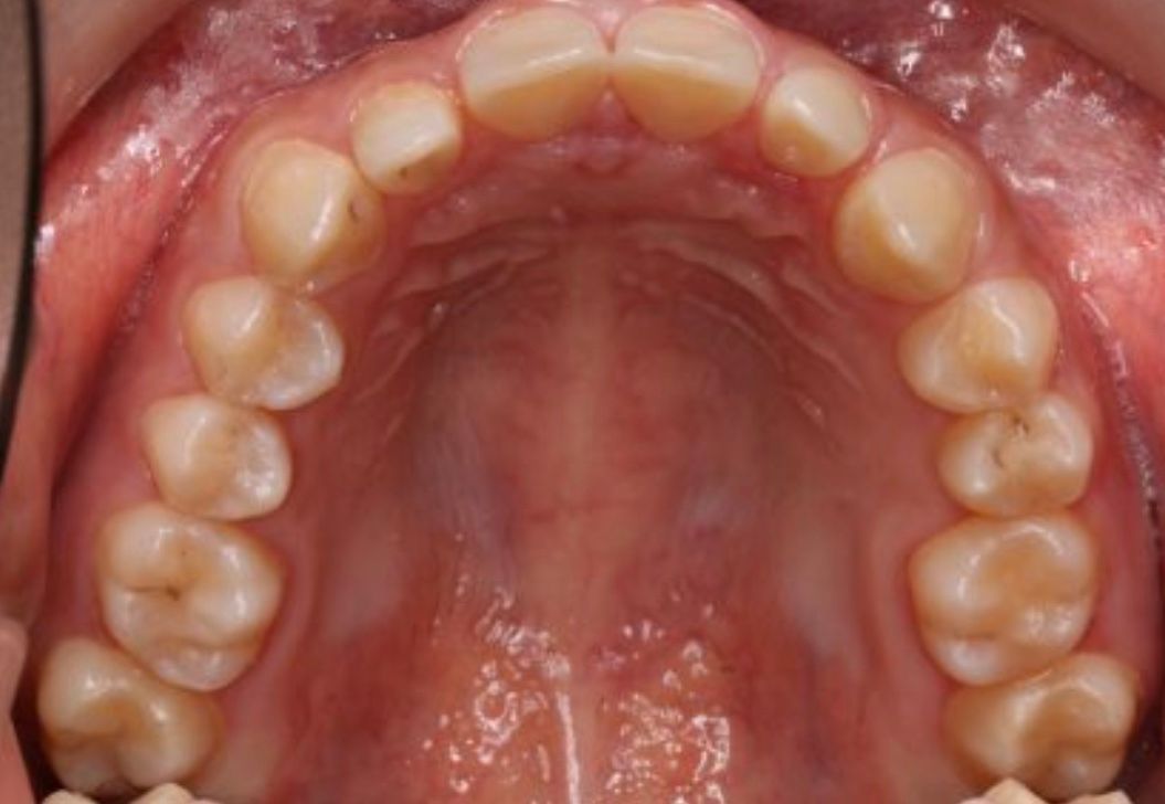 Eduardo Huerta Ramírez-4