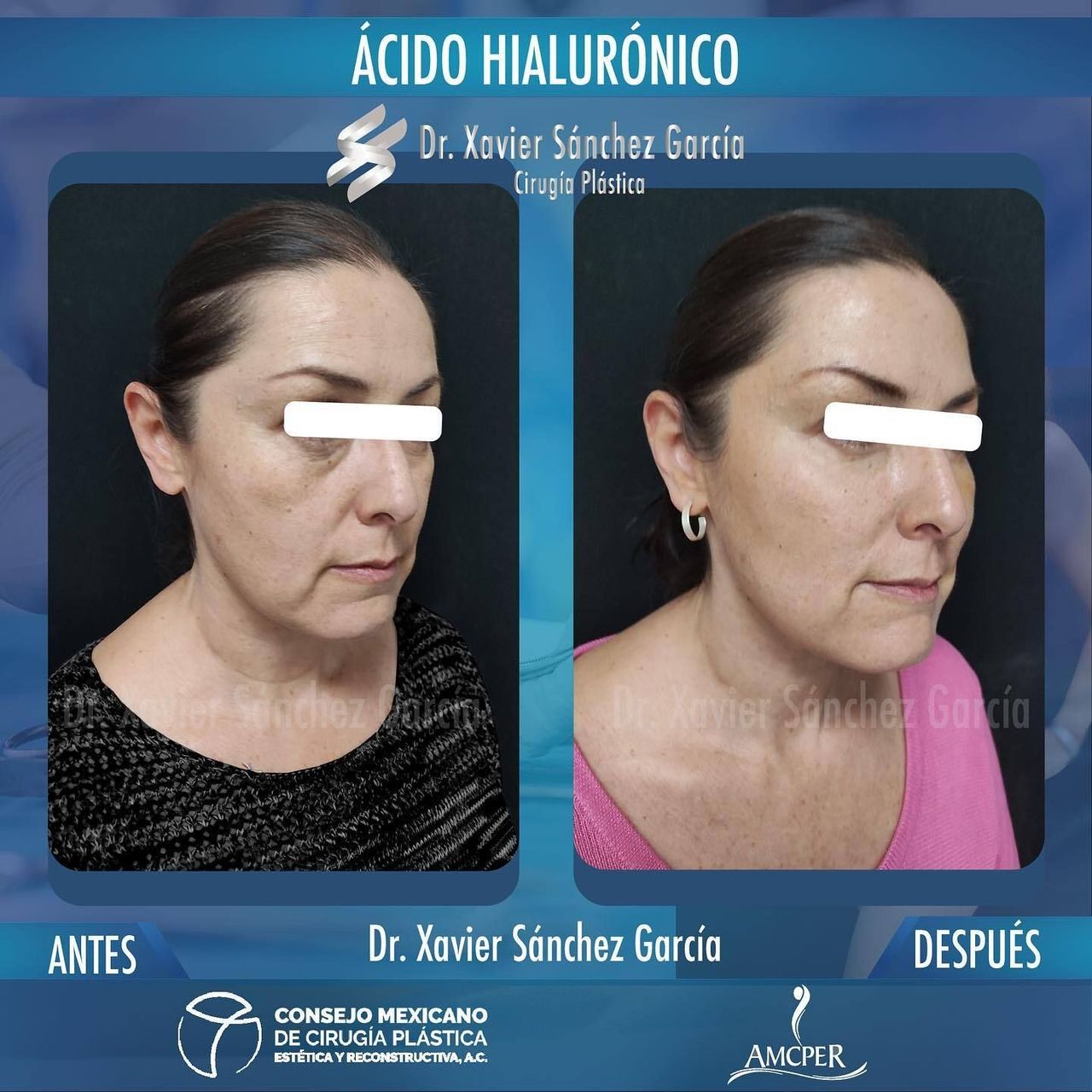 Xavier Sánchez García-35