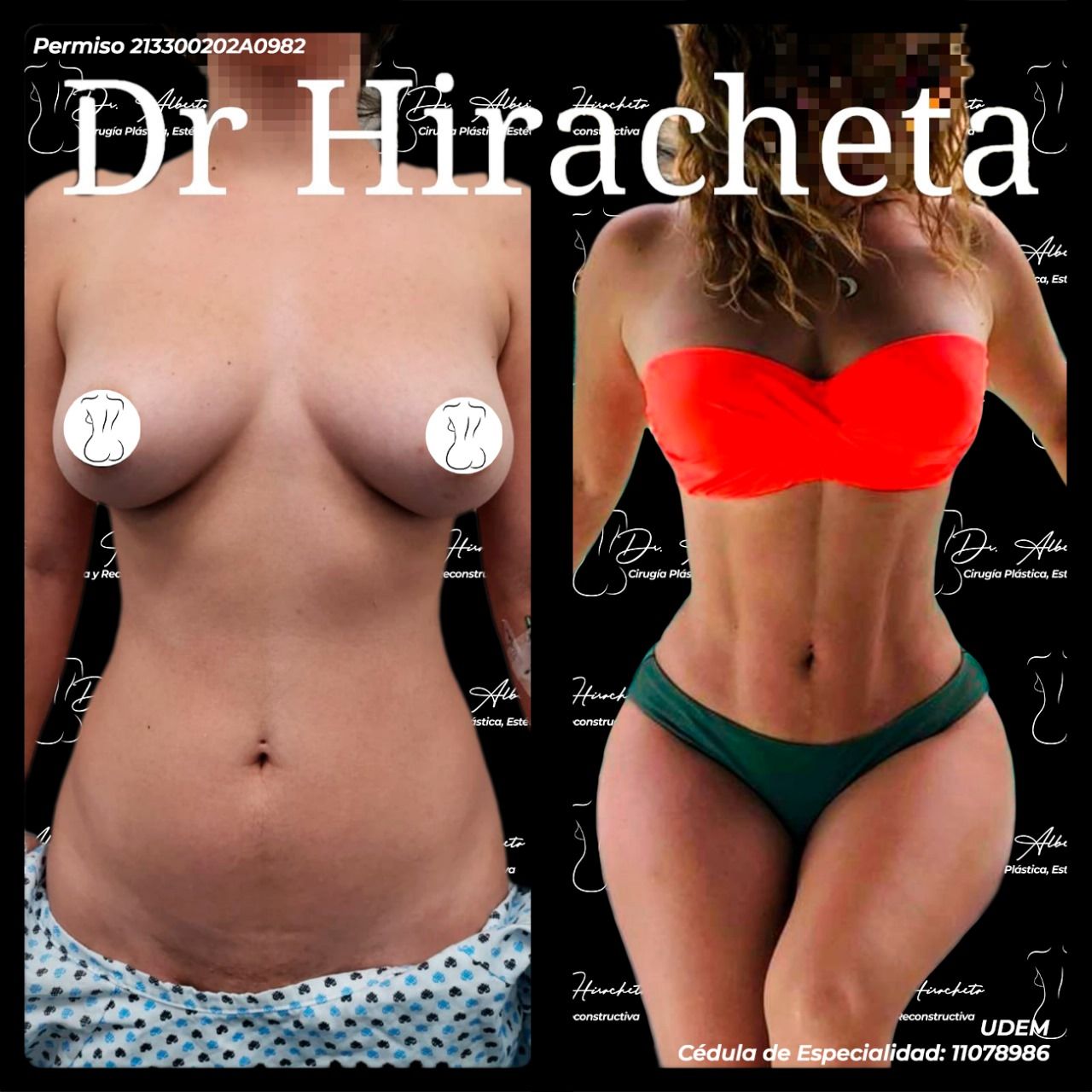 Alberto Hiracheta Torres-22