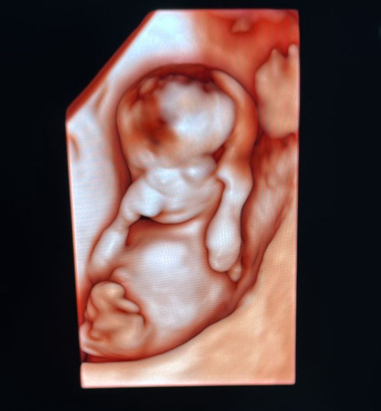 Carlos Ulises Romero Zarate-8