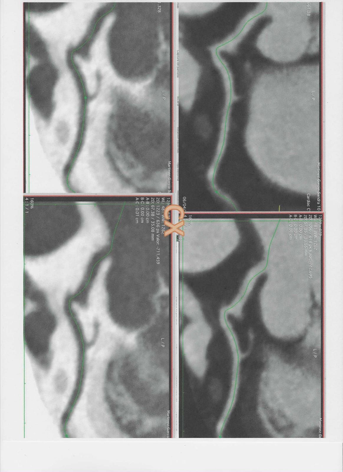 Luis Enrique Vera   Arroyo-7