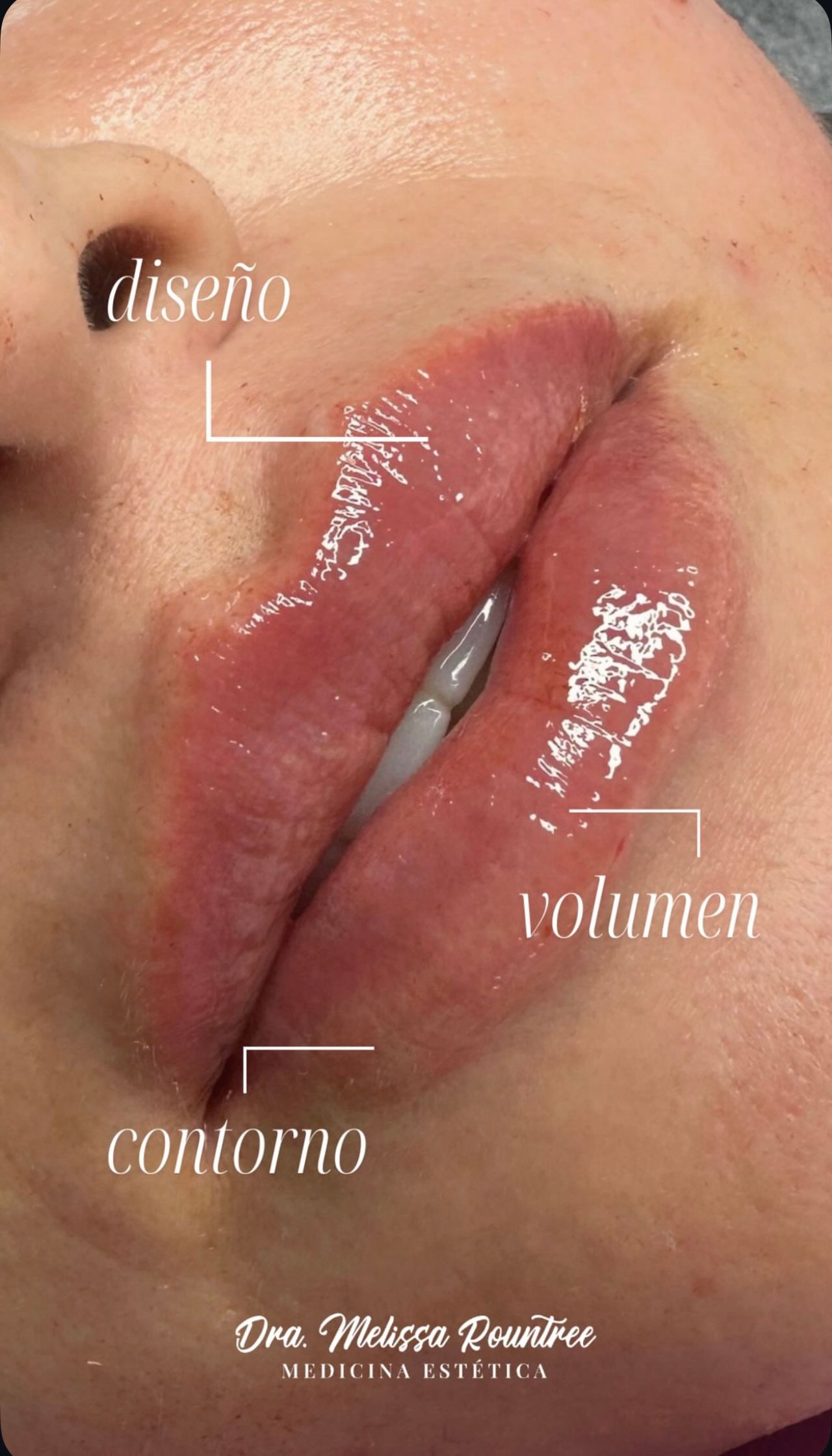 Melissa G. Rountree-0