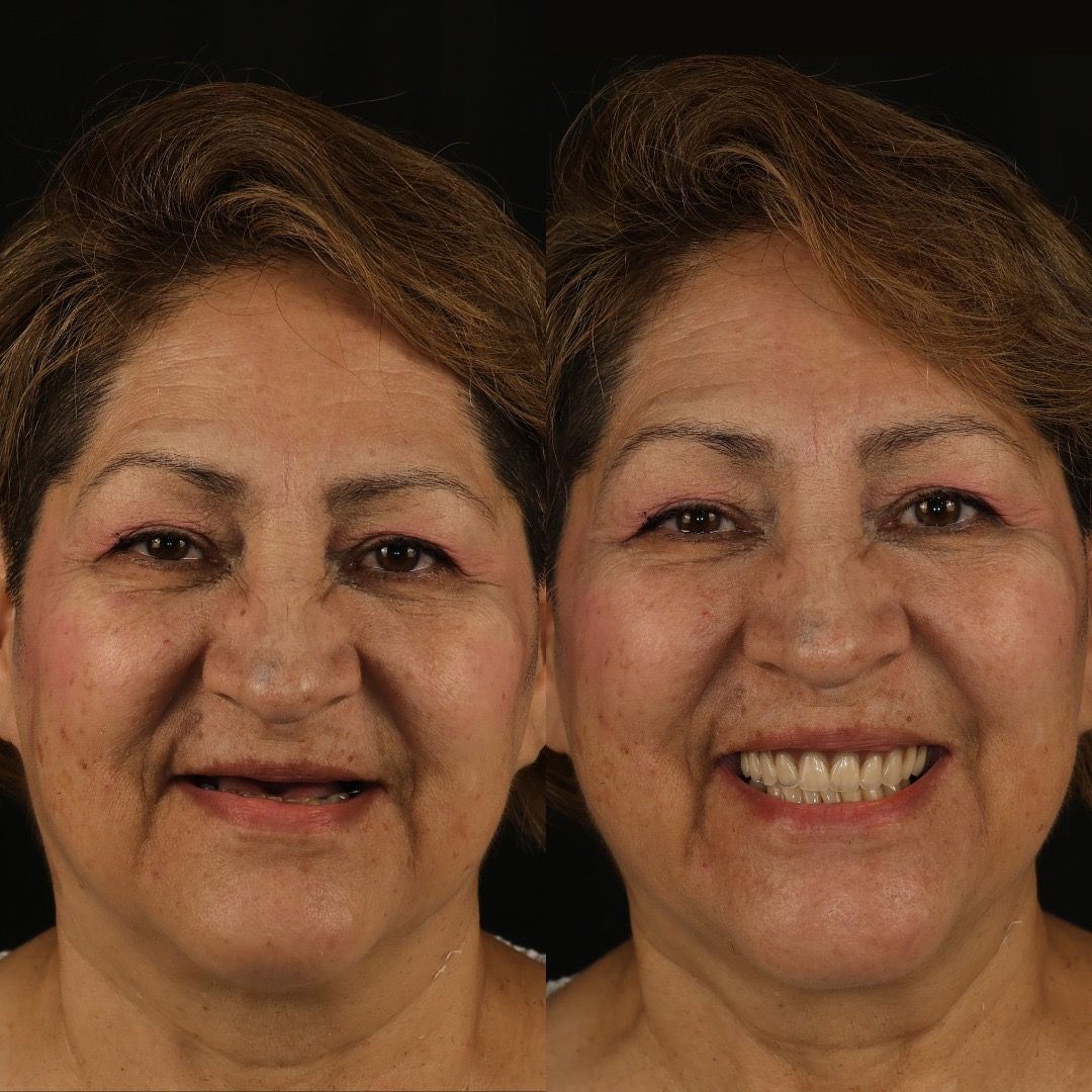 Ivan Torres Rascon-2