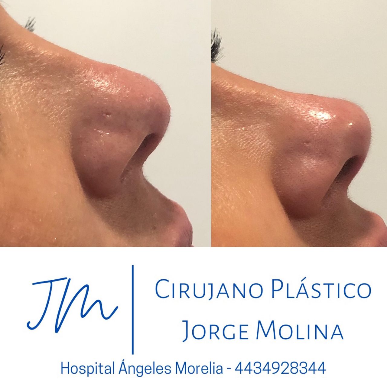 Jorge Eduardo Molina Ortega-8