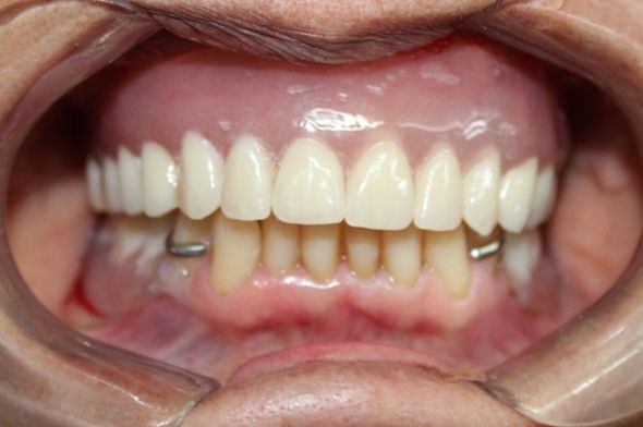 Juan Manuel Méndez Ferrusco-10