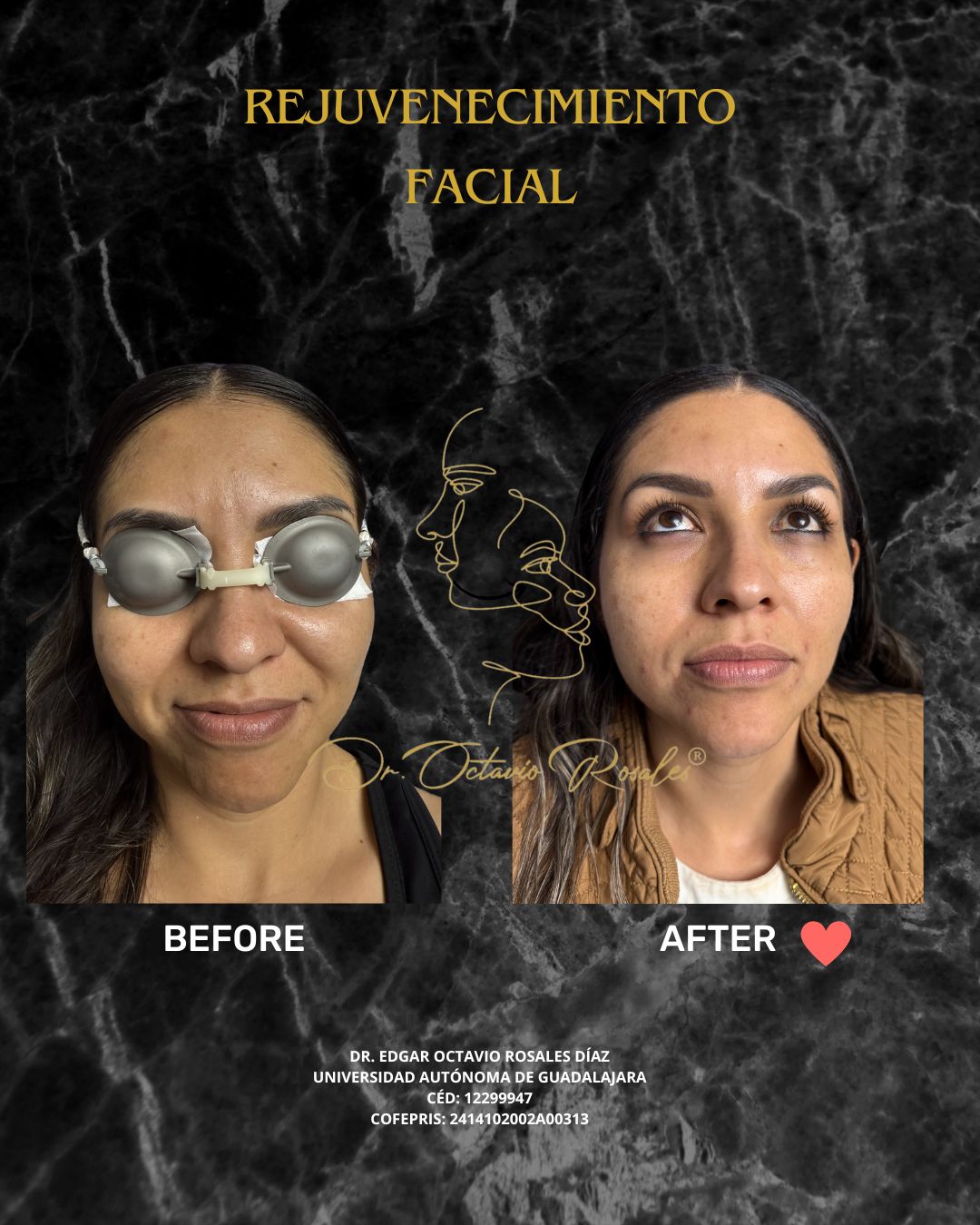 Edgar Octavio Rosales Diaz-16