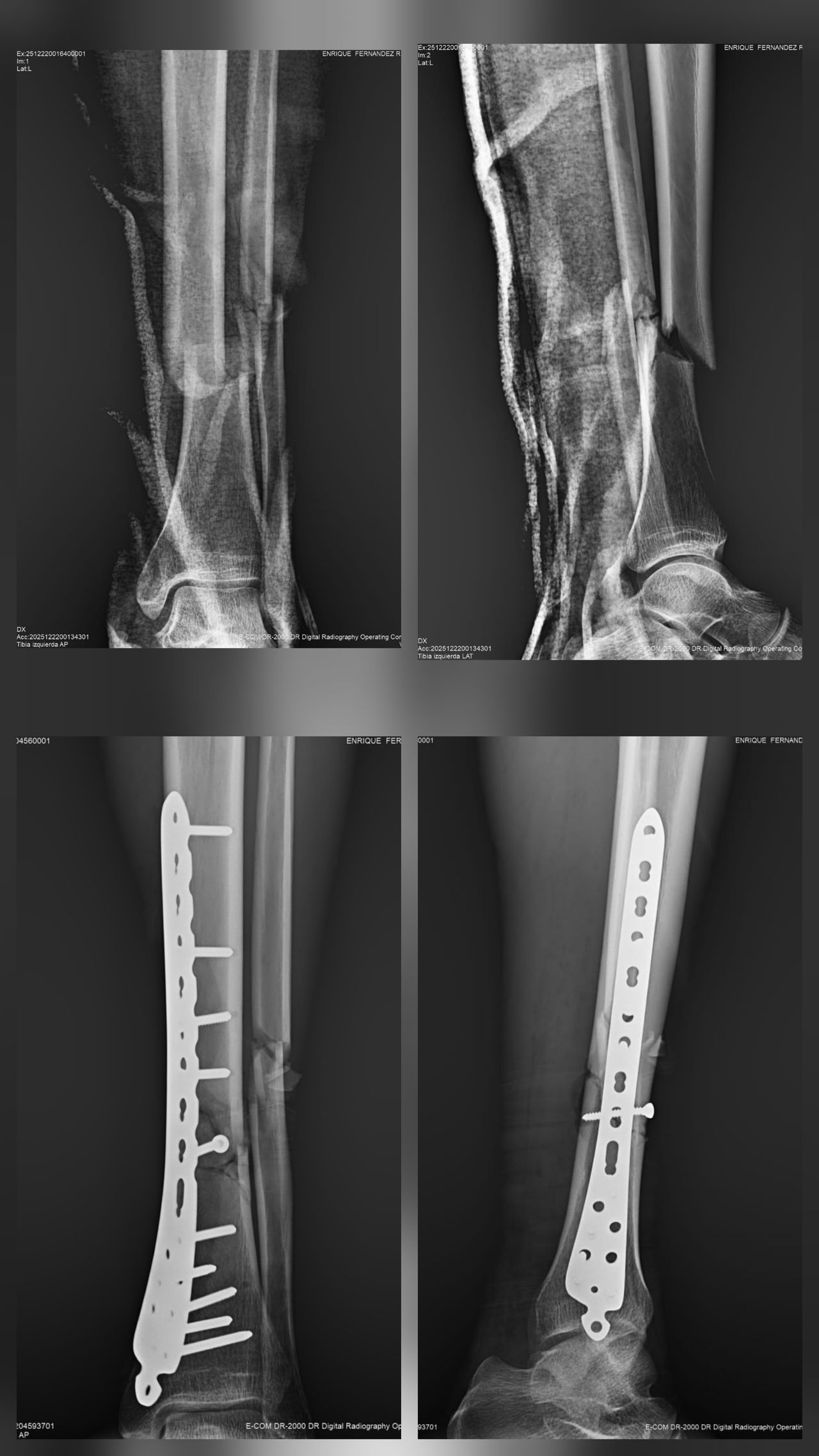 Amando Ramirez Zavala-3