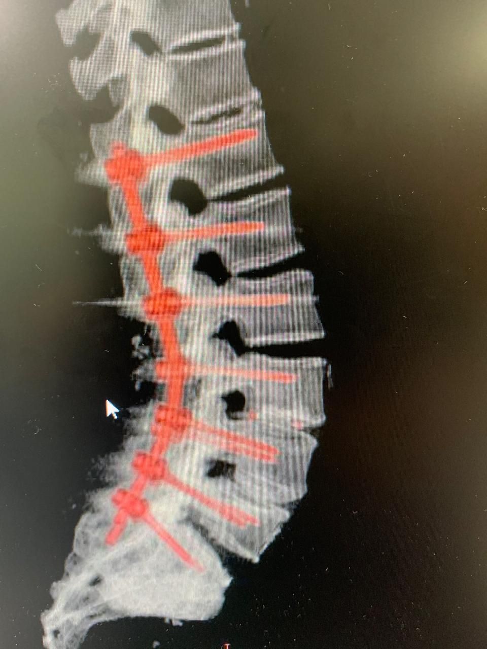 Ricardo Reyna Reynoso-7