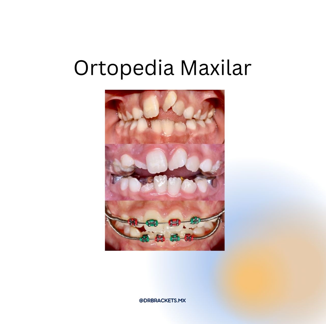 Bryan Patricio Brazales Molina-3