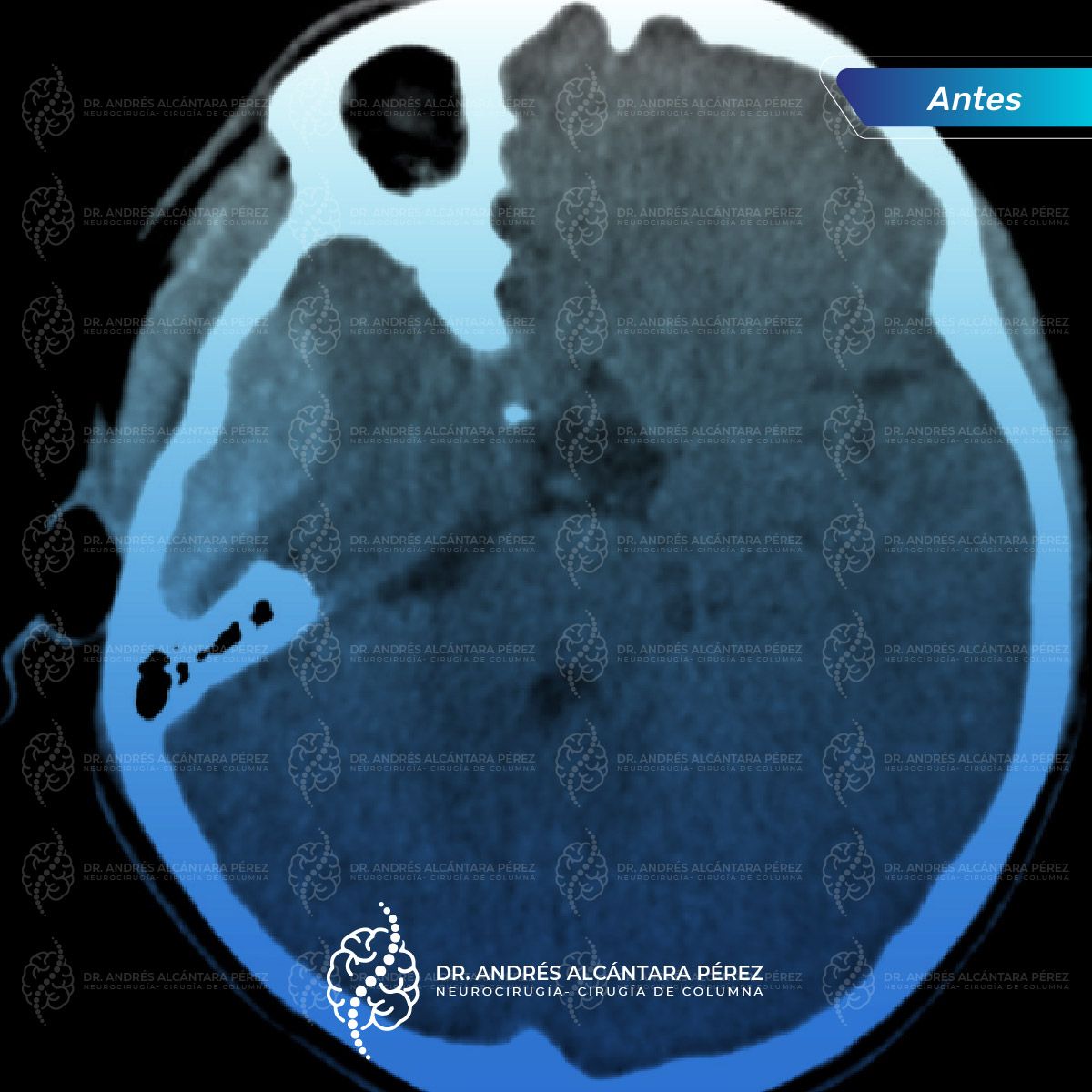 Andres Alcántara Pérez-20