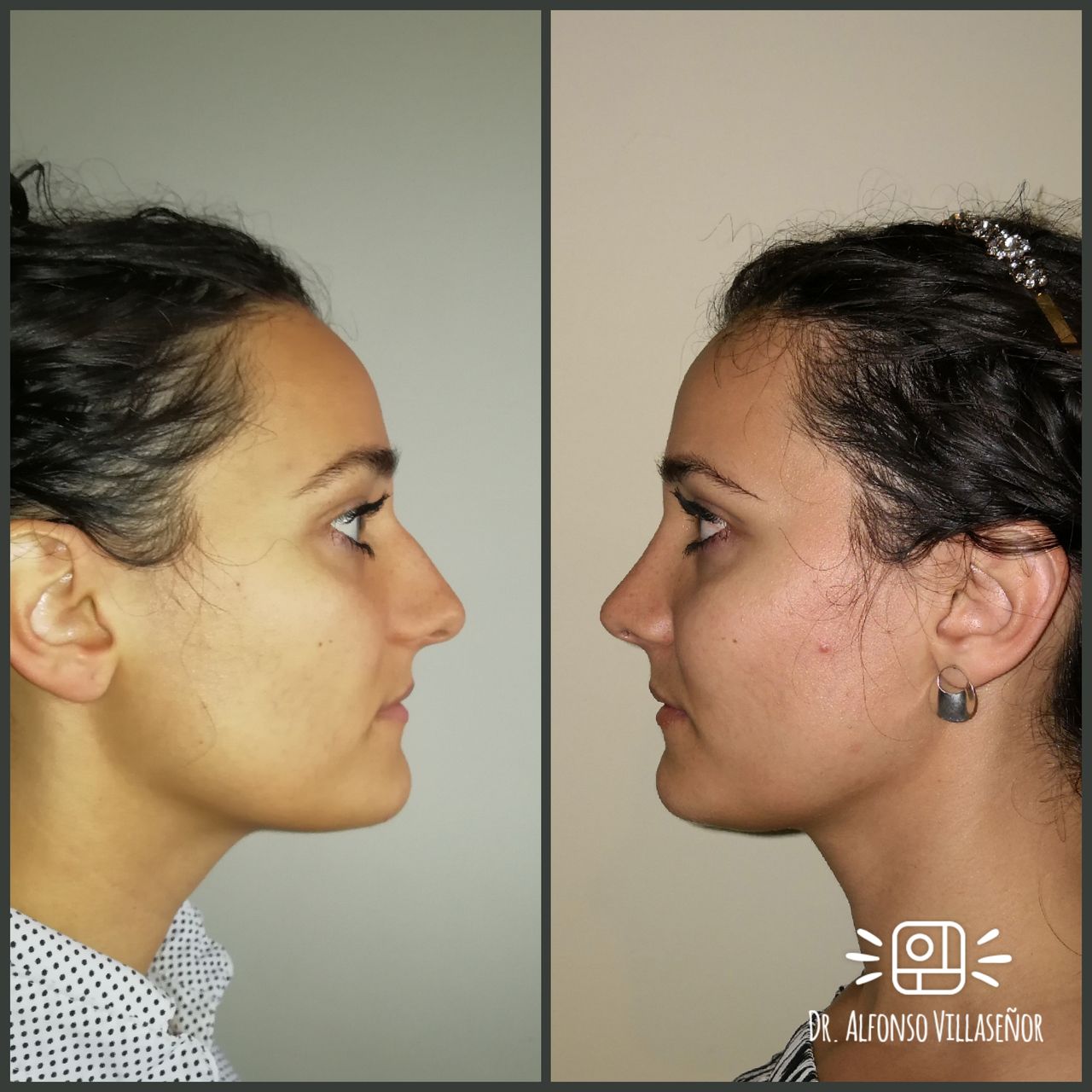 Alfonso Villaseñor Herrero-5