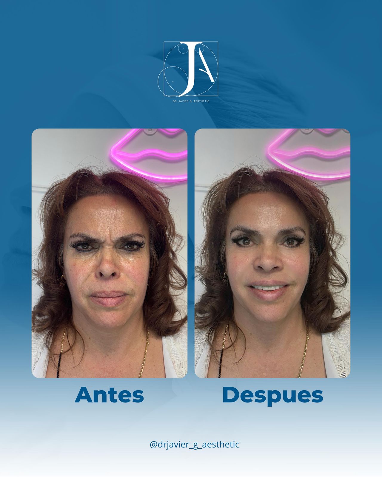 Javier Aztegui Galindo-4