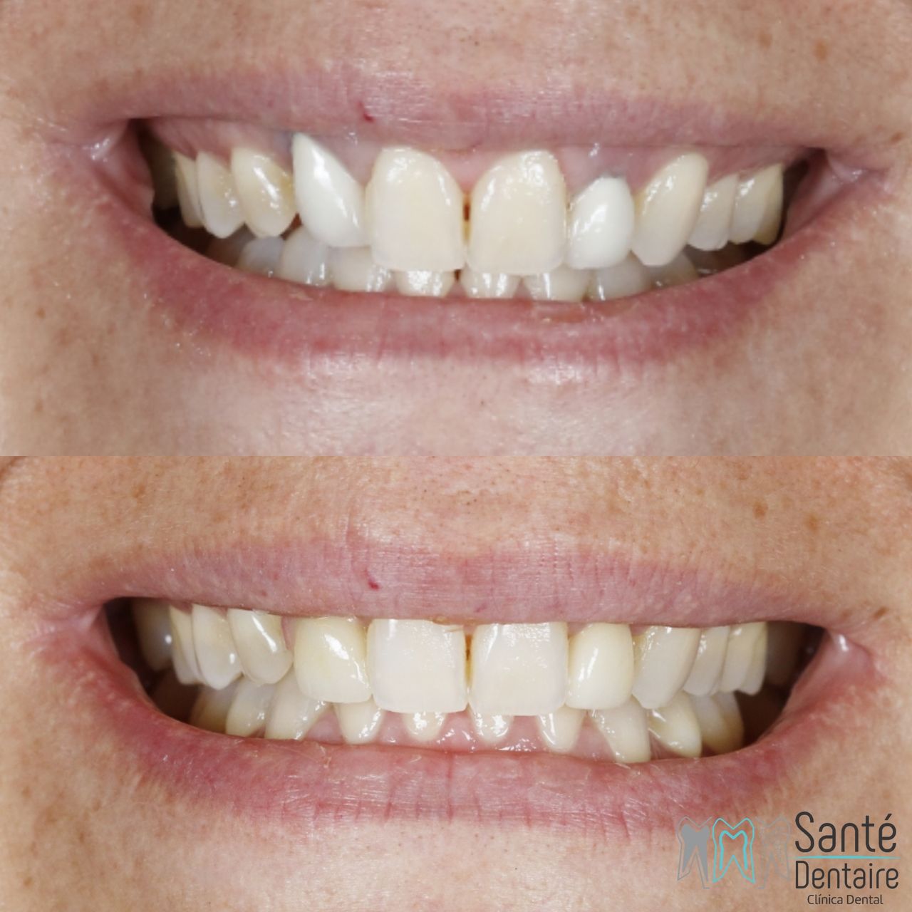 Daniel Oñate Robledo-22