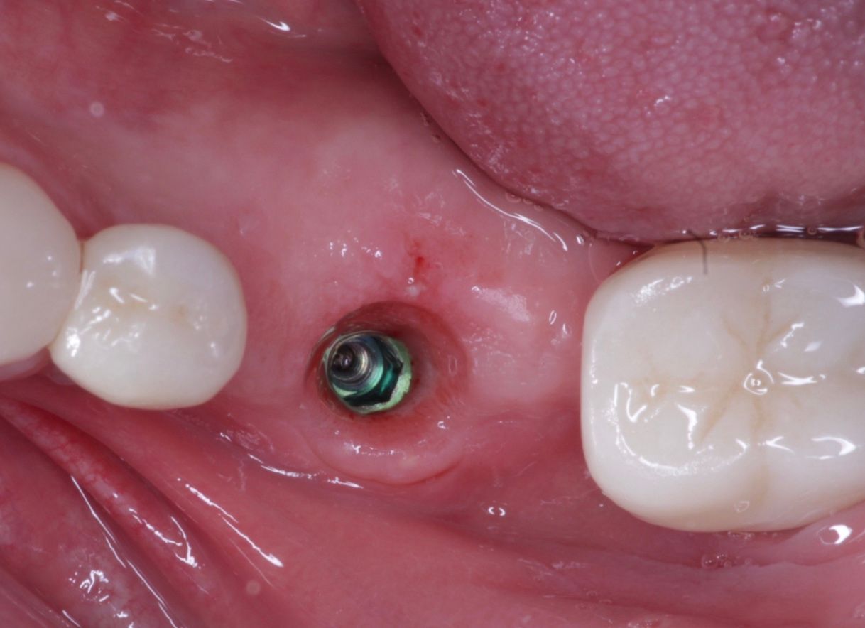 Josué Márquez Gómez-77