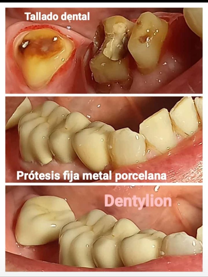 Jessica De La Barrera Valladolid-3