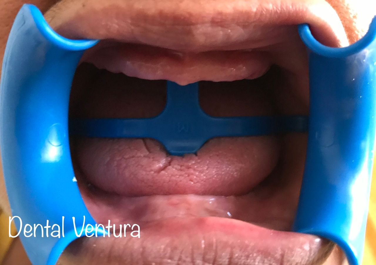 Antonio Cerda Ventura-10