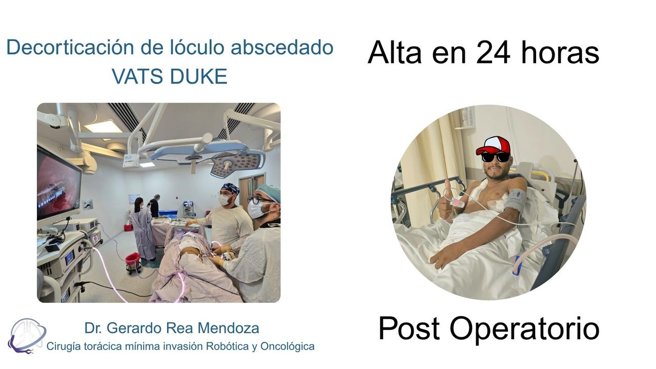 Gerardo Rea Mendoza-12