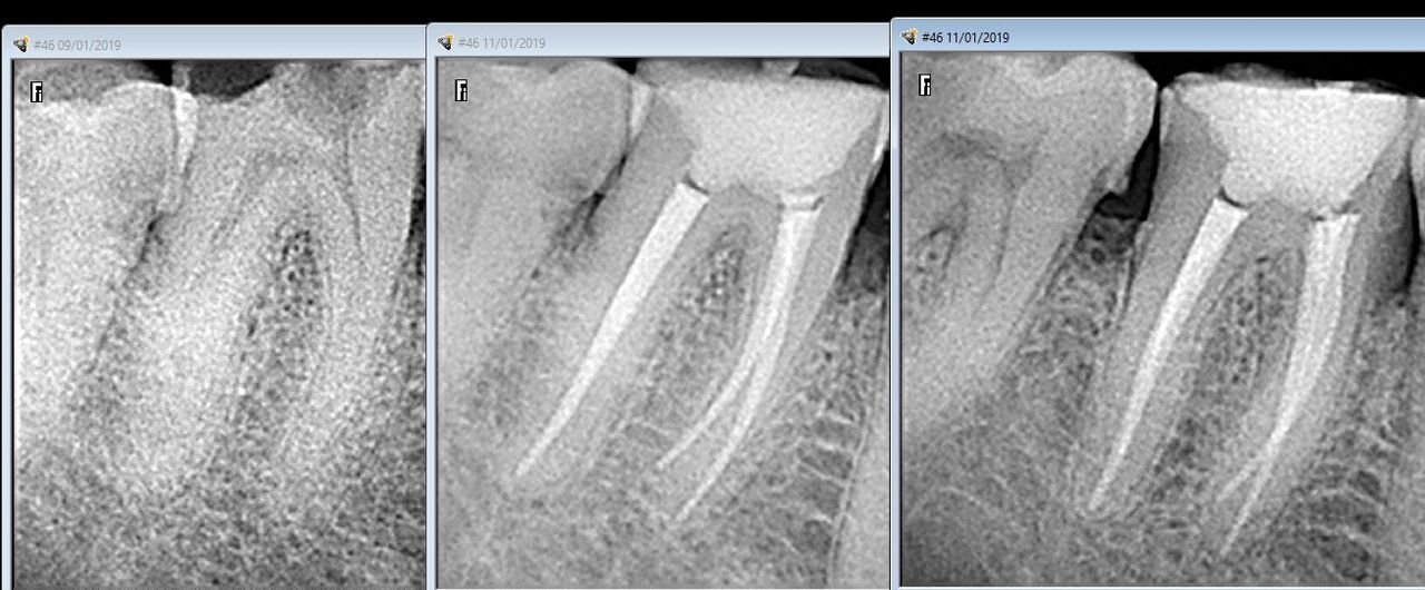 Lesli Erendira Campechano Zaragoza-11