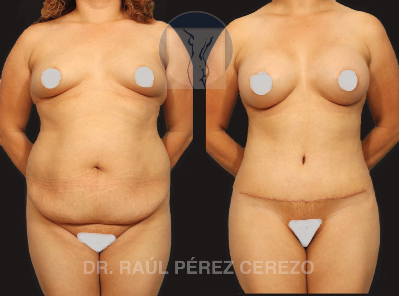 Raúl Pérez Cerezo-4