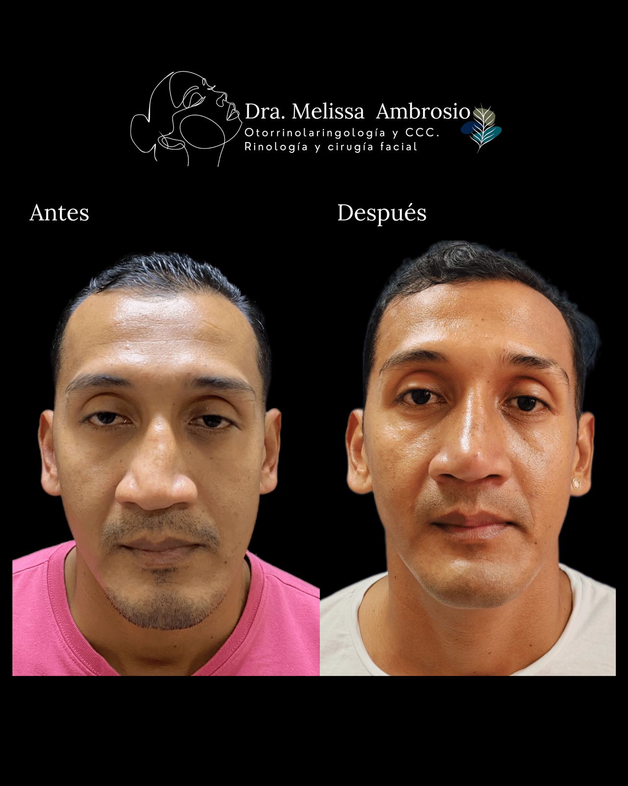 Melissa Guadalupe Ambrosio Mendoza-12