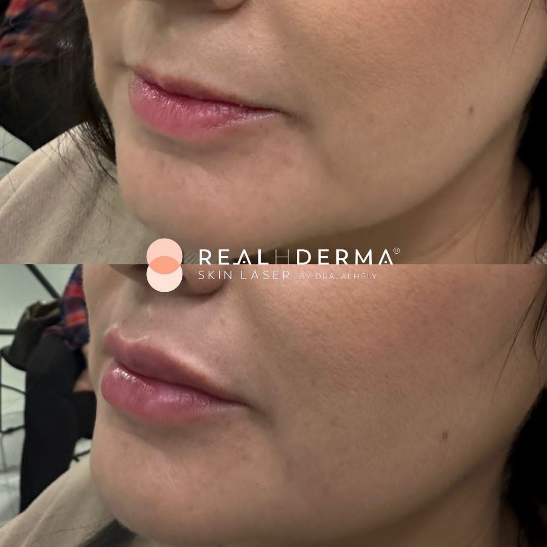 Laura Alheli Niebla Maldonado-7