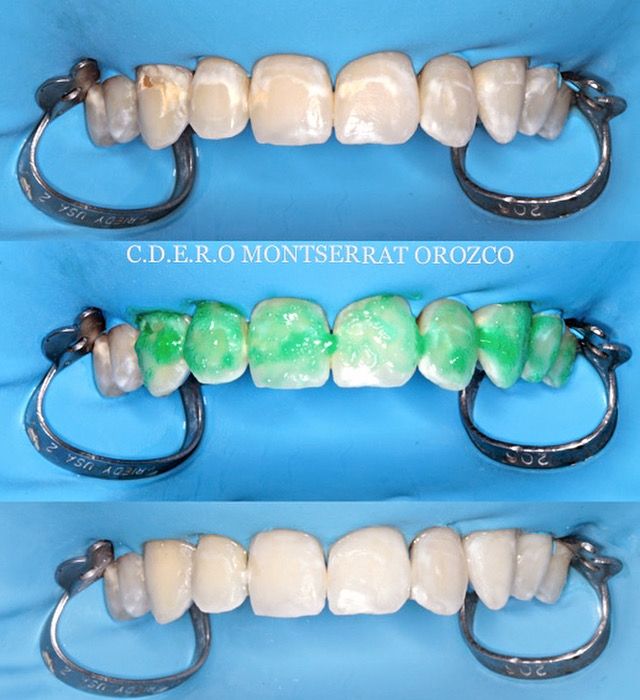 Aide Montserrat Orozco Gutierrez-46