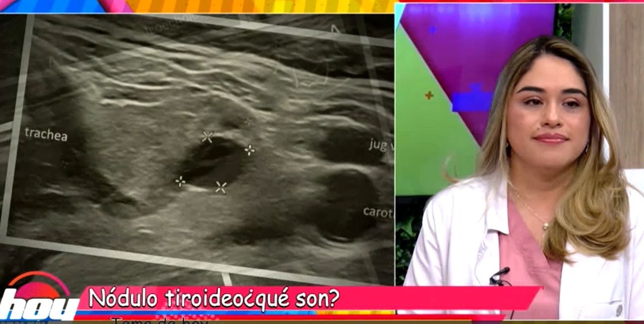 Mary Yeyzel Ortega Aranda-18