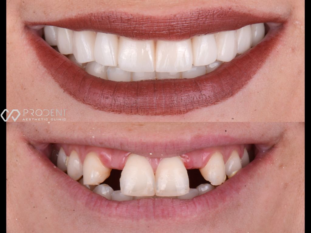 Ulises Pérez Murillo-87