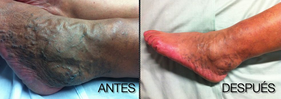 Alfredo Velasquez Maravert.-3