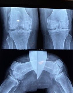 Josmar Adrián Lopez Eng-4