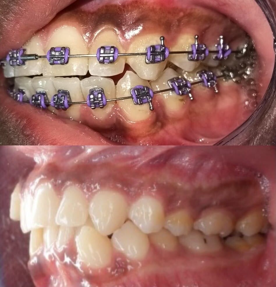 Luz Anel Valente Lozano-9