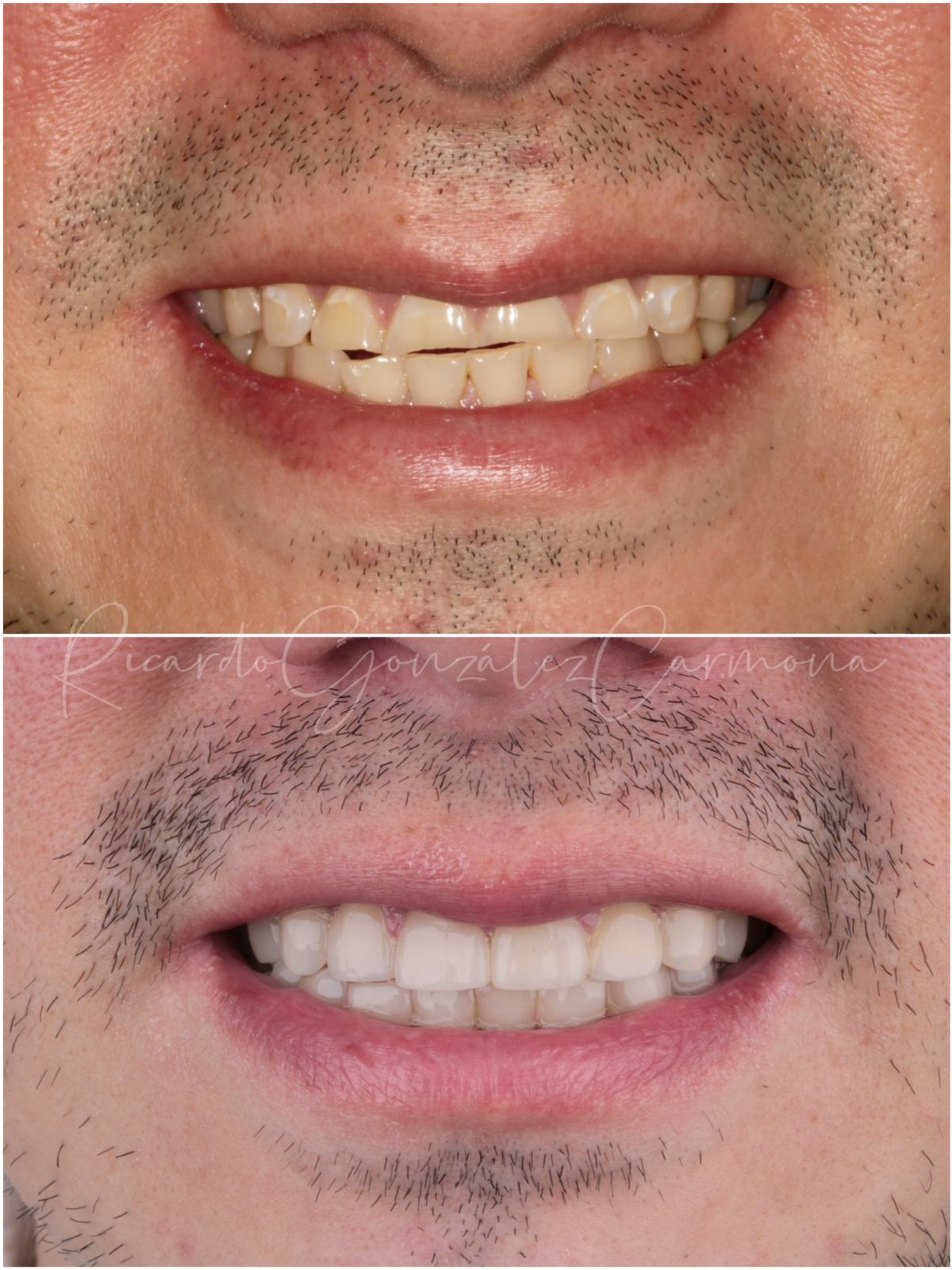 Ricardo González Carmona-16