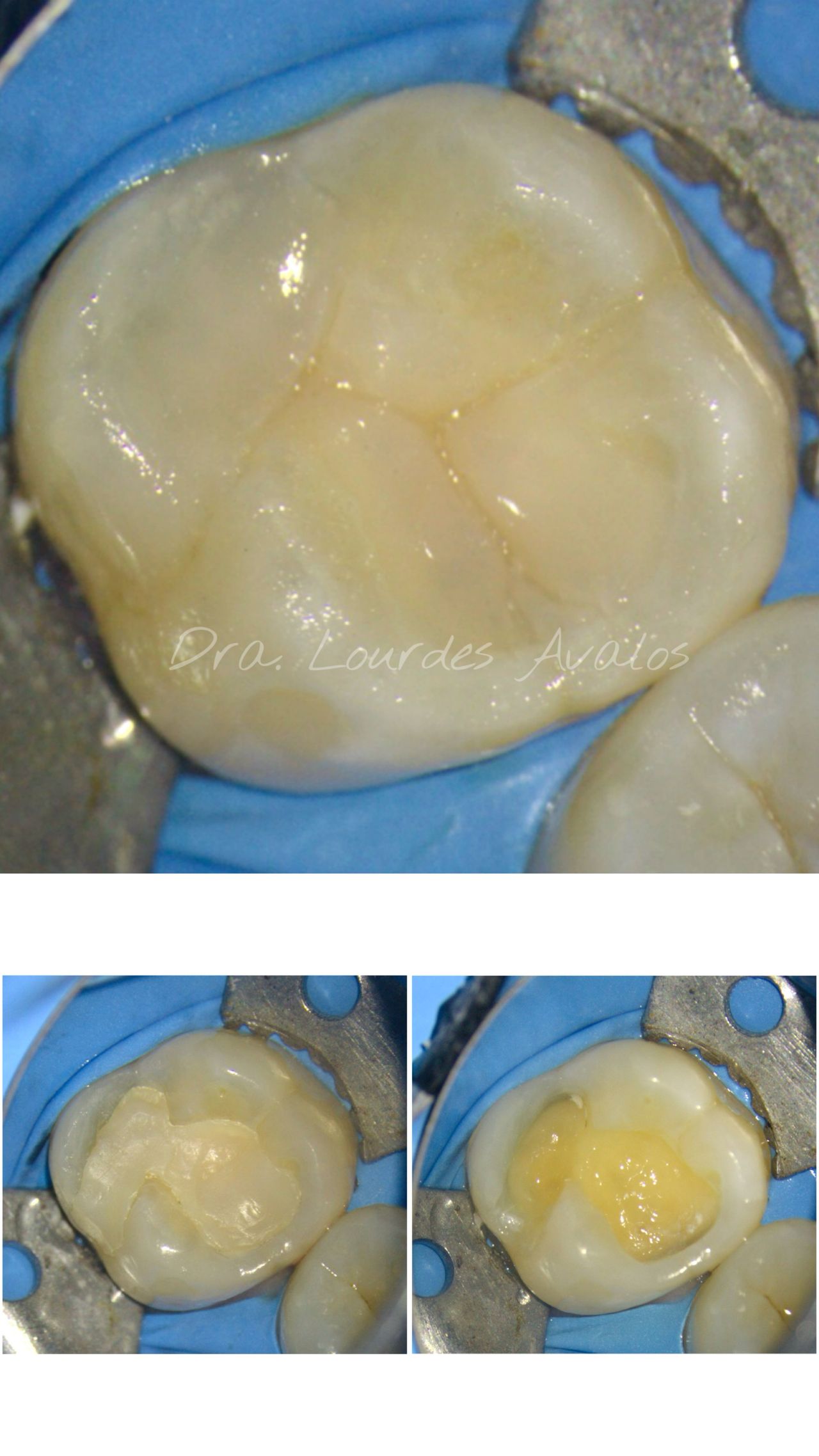 Lourdes Avalos Piña-6