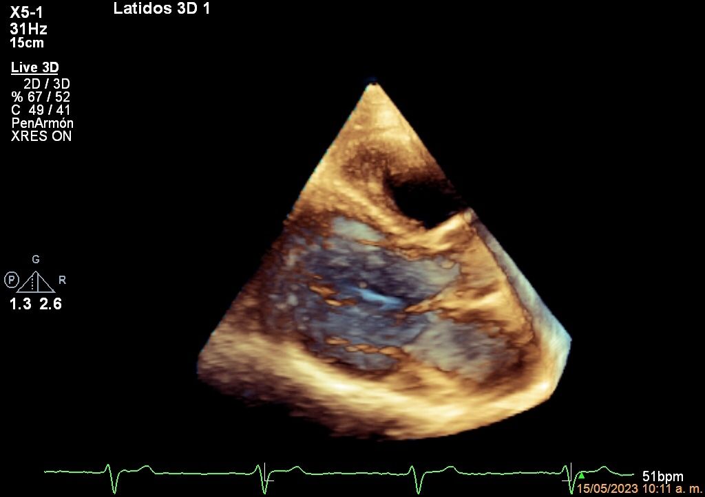 Heriberto Pruneda Ayala-14