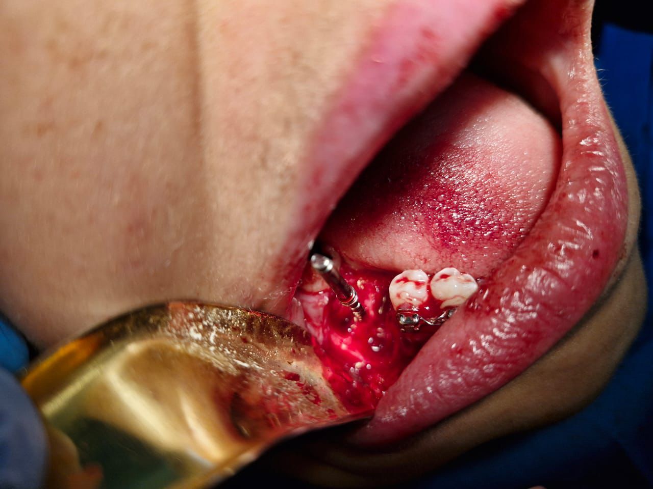 Jair Contreras García-29