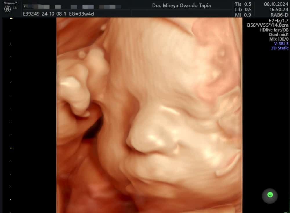 Mireya Ovando Tapia-9