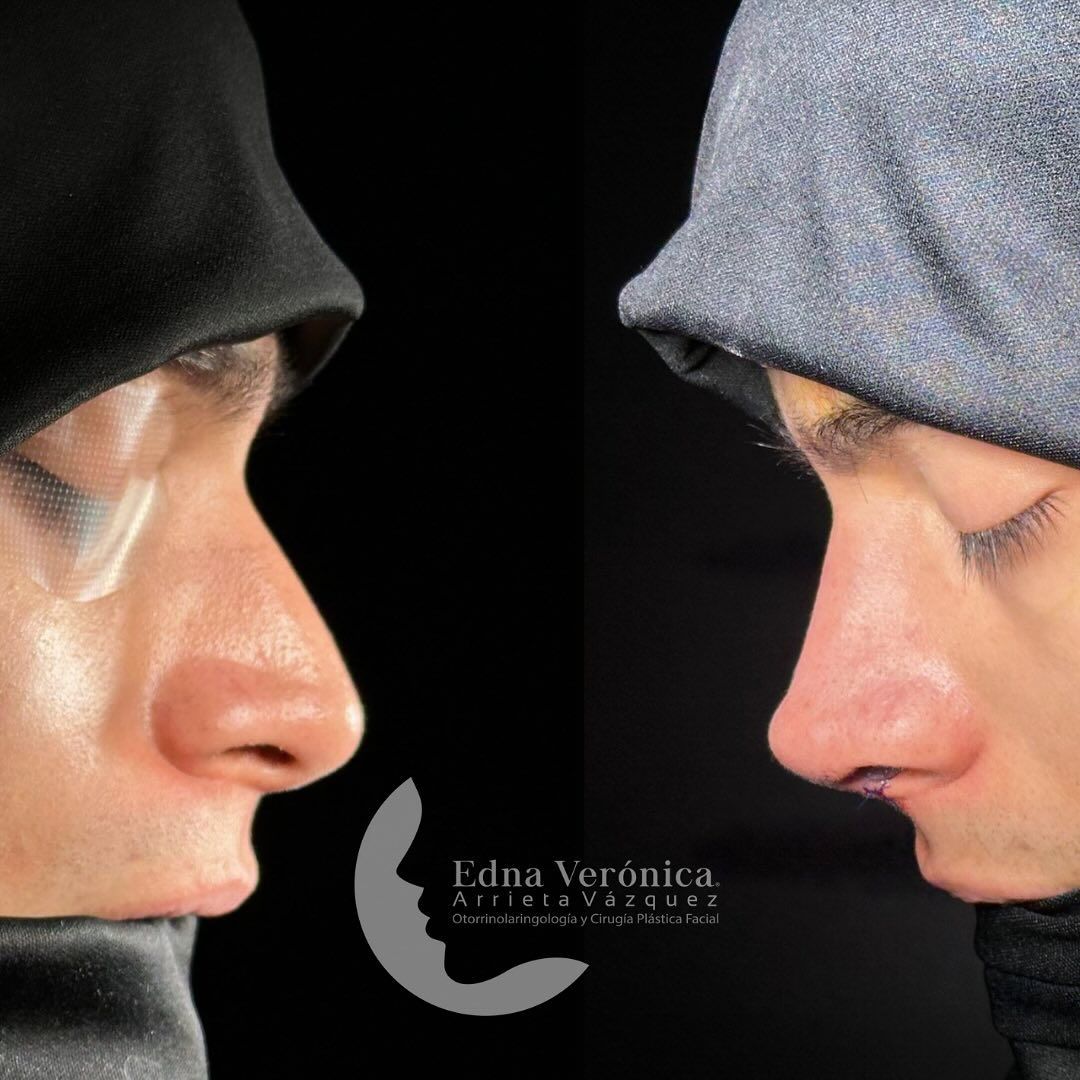 Edna Verónica Arrieta Vázquez-11