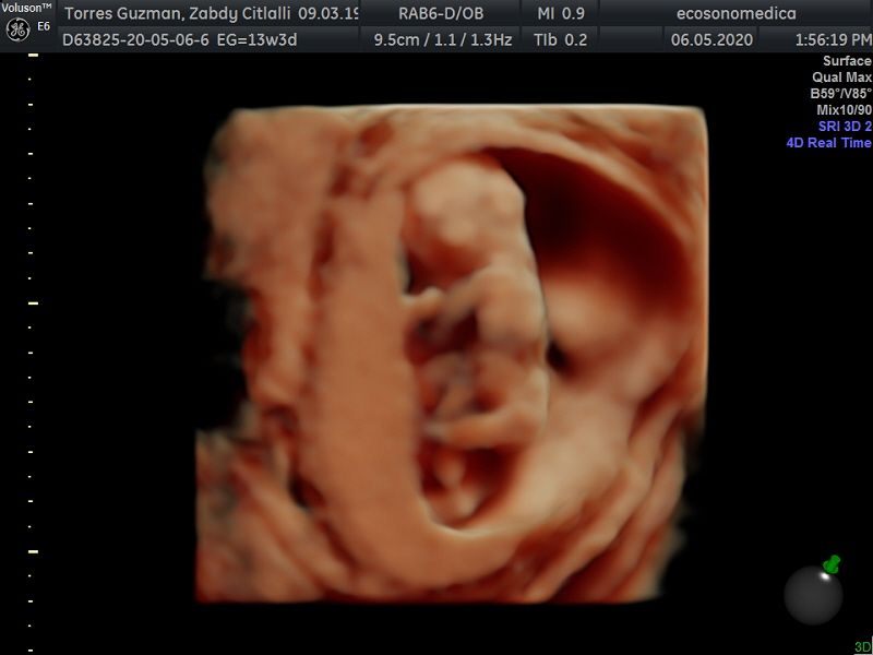 Héctor Bernardo Acevedo Manrique-17