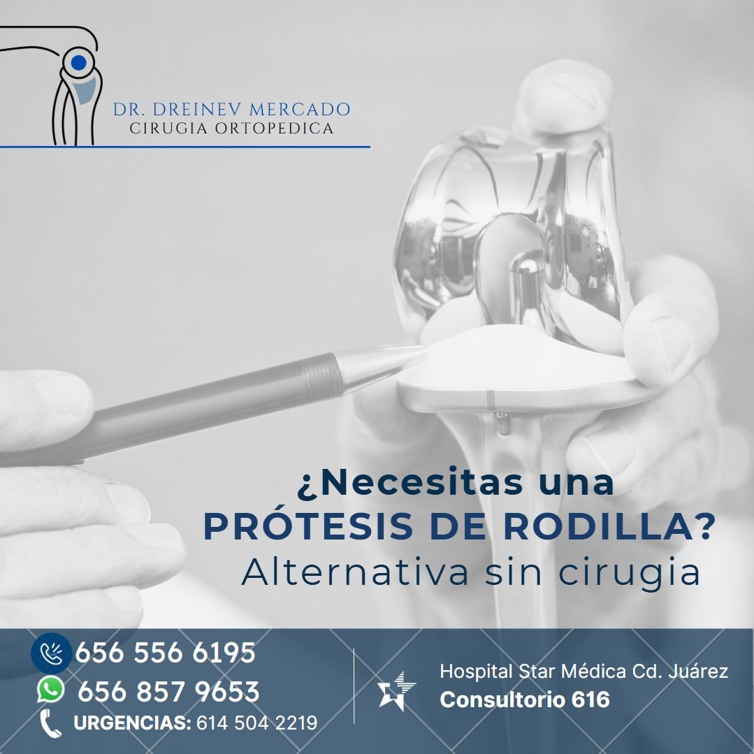 Dreinev Mercado Meza-0