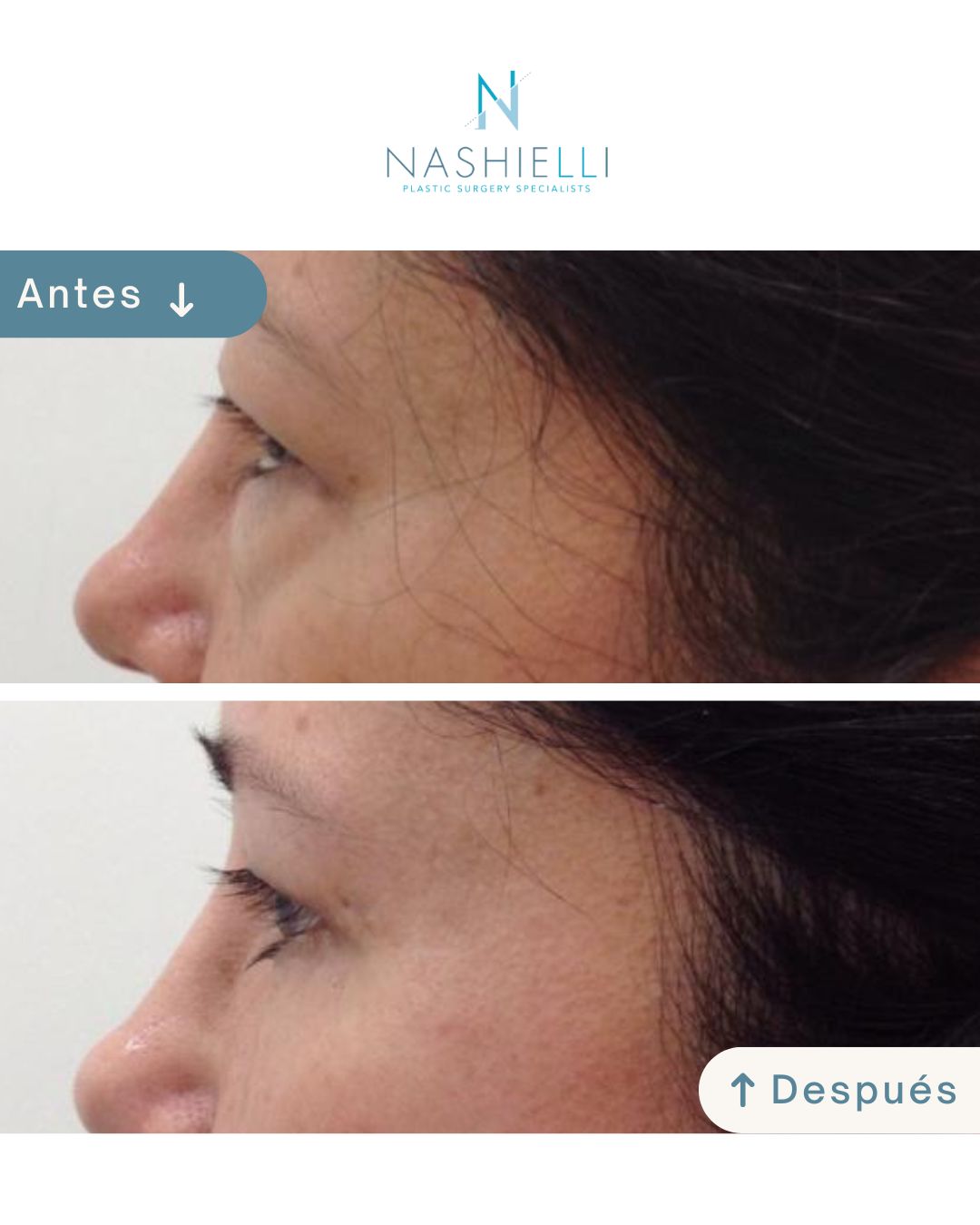 Nashielli Torres Espinosa Chiu-33