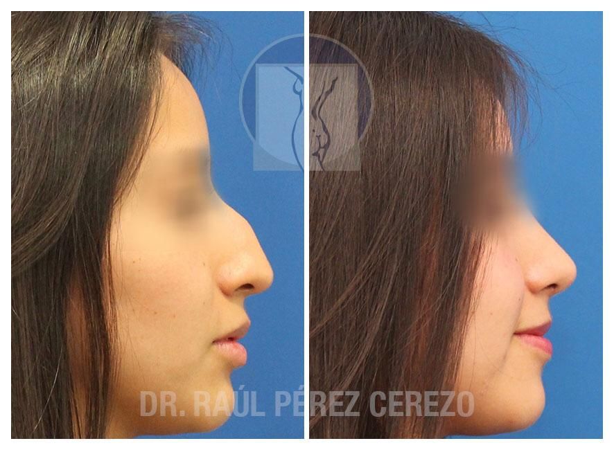 Raúl Pérez Cerezo-17